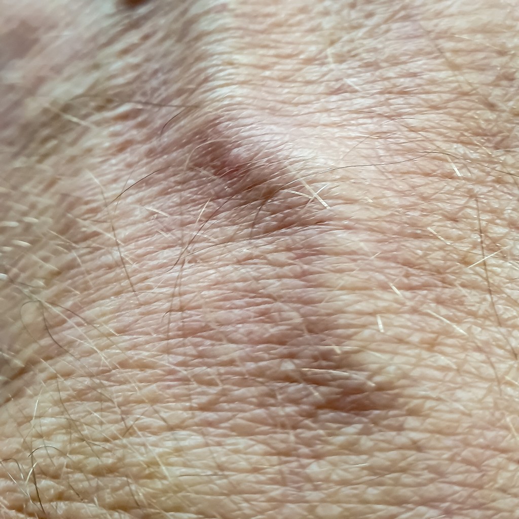 Image of skin on a hand